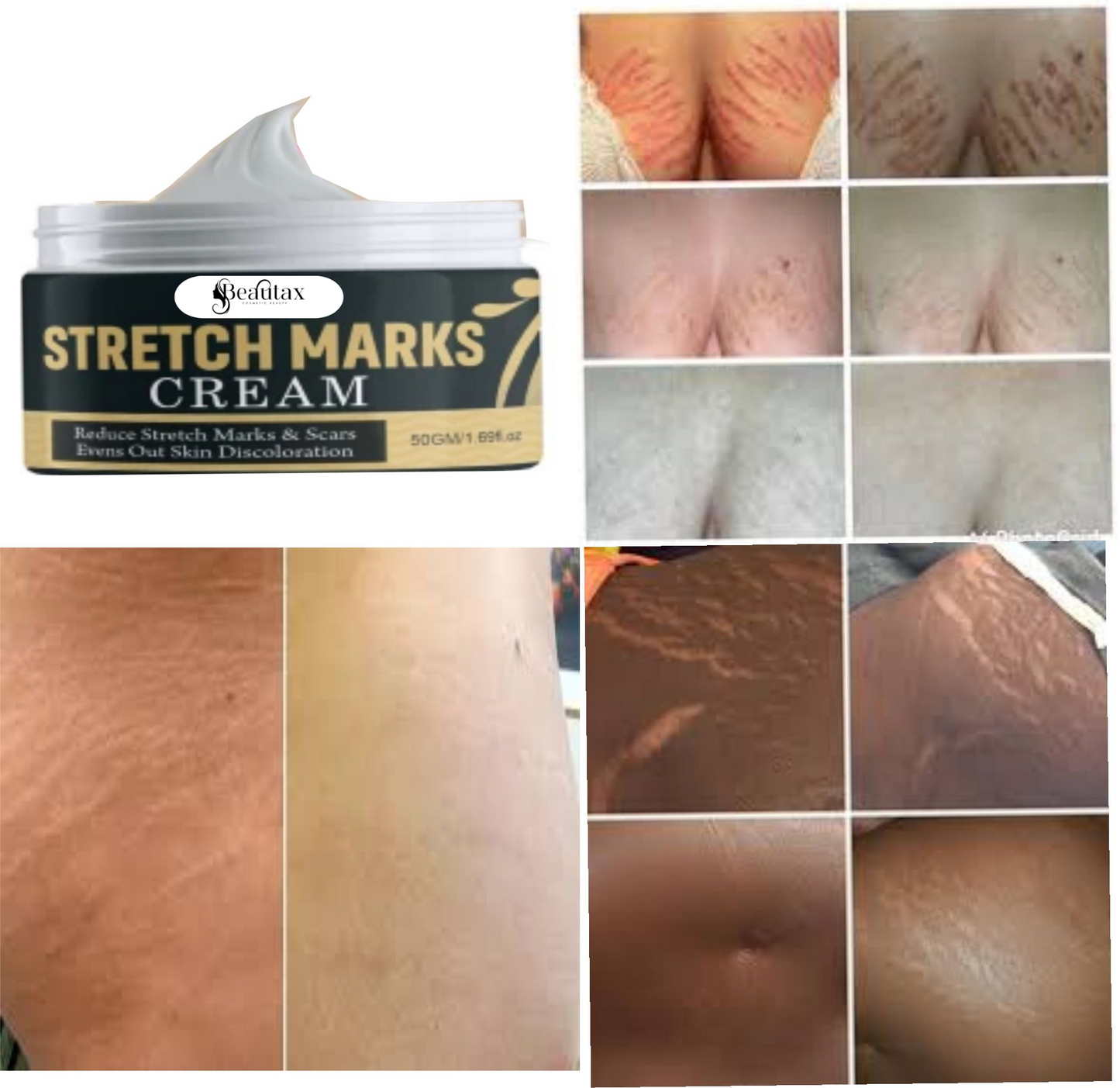 Scratch Marks Cream