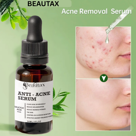Anti Acne Serum For All Types of Skin