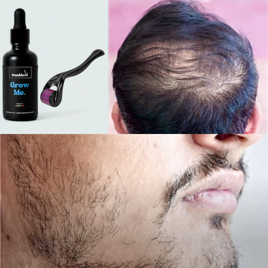 Hair Growth Serum + Derma Roller (30ML)