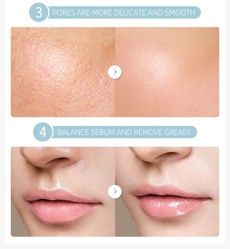 Vitamin C Brightening Face Serum for All Skin Types