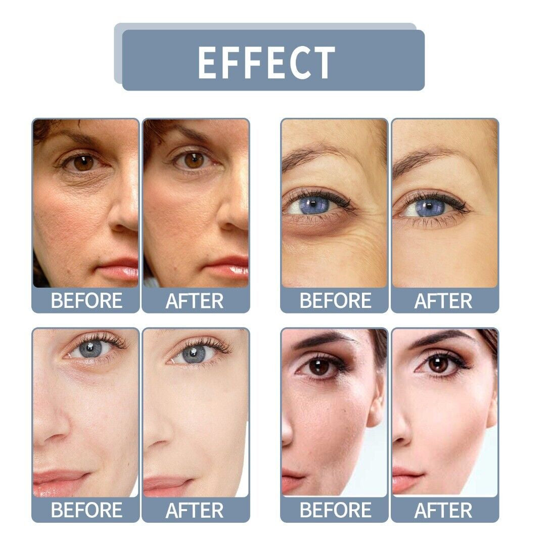 Vitamin C Brightening Face Serum for All Skin Types